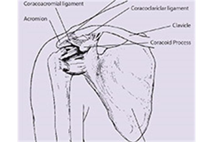 از-آسیب-دیدگی-مفصل-اکرومیو-کلاویکول---قسمتی-از-شانه---بیشتر-بدانیم